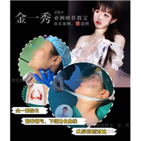 上海金一秀磨骨整形 