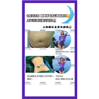 上海抽脂整形 