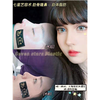 上海七星整形肋骨隆鼻 