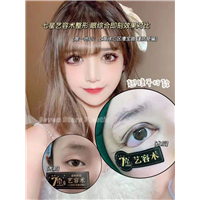 上海七星眼综合整形术后即刻效果 