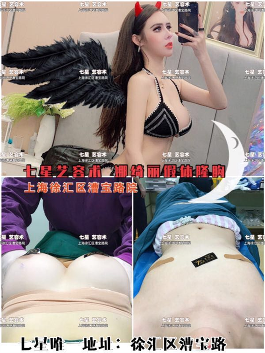 上海七星艺容术隆胸整形 