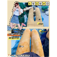 上海吸脂整形 