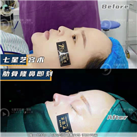 上海七星艺容术鼻综合整形 