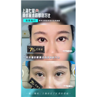 上海七星艺容术眼综合修复