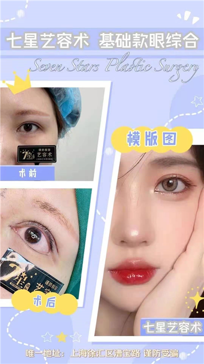 上海七星眼综合修复整形 