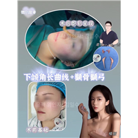 金一秀磨骨怎么样 