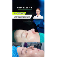 鼻尖上转折要怎么做出来