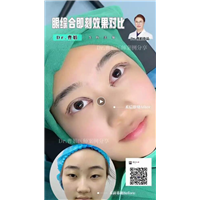 曹娟医生眼部案例