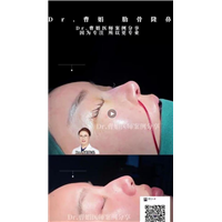 曹娟医生鼻部案例展示