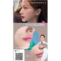 曹娟医生人中案例