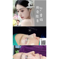 上海曹娟整形医生鼻部案例