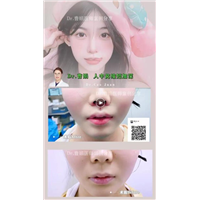 曹娟医生人中案例