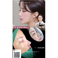 曹娟医生鼻部案例展示