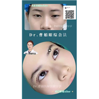 曹娟医生眼部案例