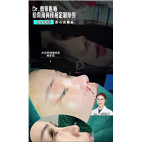 鼻头大就一定要切鼻翼吗不一定