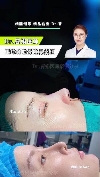 鼻尖上转折要怎么做出来