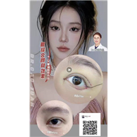 曹娟医生眼部案例