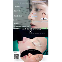 曹娟医生鼻部案例展示