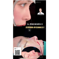 曹娟医生鼻部案例展示