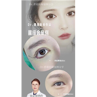 如果埋线双眼皮和切开双眼皮都可以