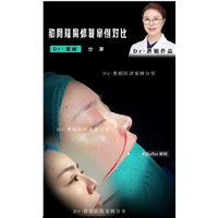 超肋鼻材料和肋软骨鼻材料效果怎么样
