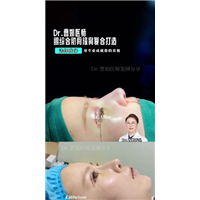 上海鼻修复整形专家曹娟医生