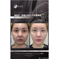 广州瑰丽诗轻医美抗衰