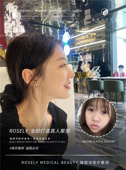 广州瑰丽诗医疗美容