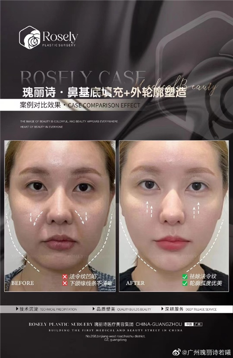广州瑰丽诗轻医美抗衰