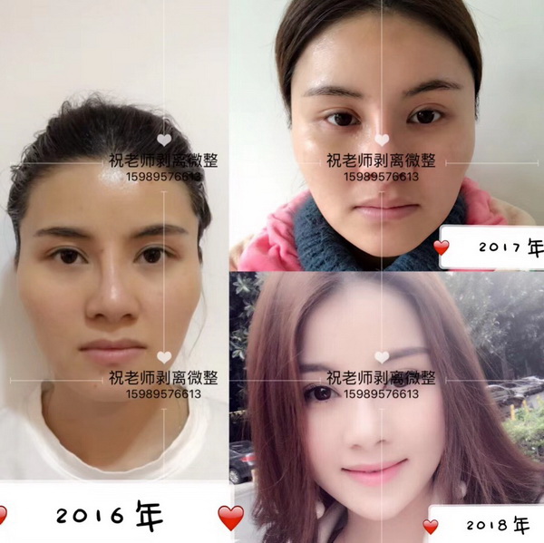祝老师微整