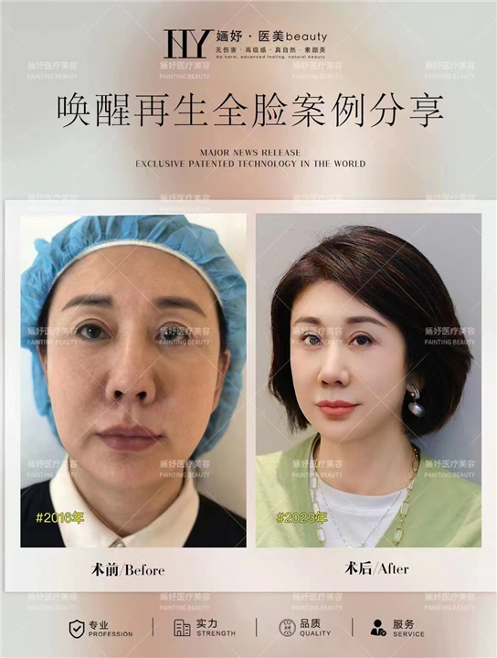 祝睿宣医美