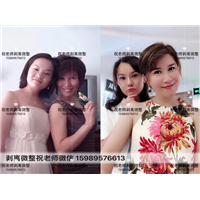 祝老师剥离微整