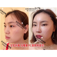 祝老师微整