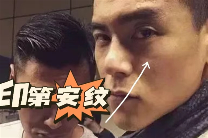 彭于晏脸上印第安纹形成原因分析，注意3件事