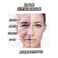 你显老的原因！你有这几道皱纹吗？
