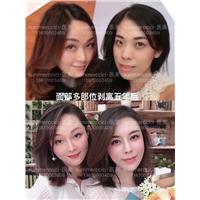 全脸剥离8年效果 