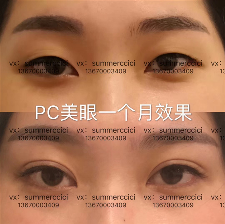 pc美眼一个月后 