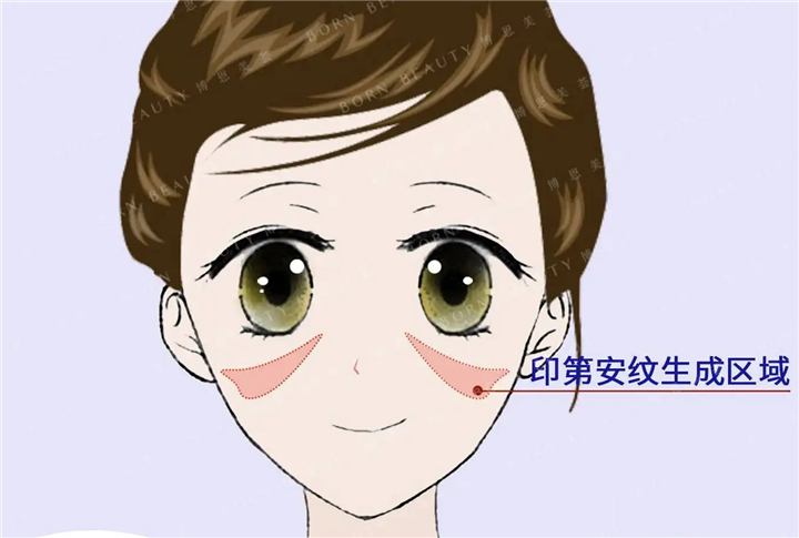 印第安纹怎么去除效果好？印第安纹好的去除方法有什么？