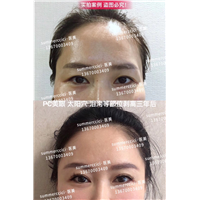 pc美眼2年多 