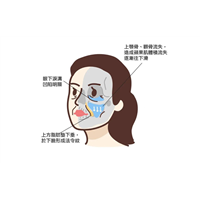 印第安纹手术多少钱？影响这种价格的因素都有哪些？