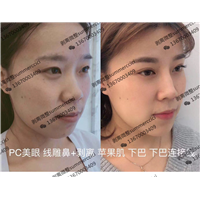 pc美眼 