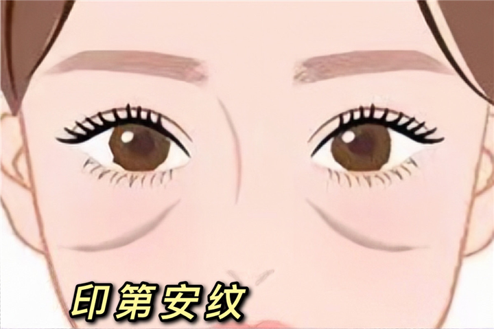 印第安纹剥离微整过程揭秘，真正的剥离术是这样去除印第安纹