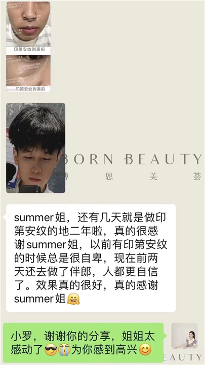 印第安纹剥离是否有副作用？