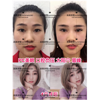 pc美眼即刻以及4个月后