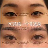 pc美眼一个月后 