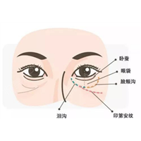 干货满满|印第安纹7大问题解答，赶紧收藏起来吧