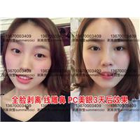 pc美眼3天效果 