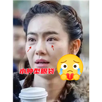 水肿型眼袋，太阔怕辣！