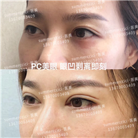 pc美眼即刻 