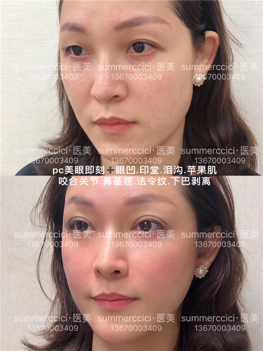 pc美眼即刻效果 